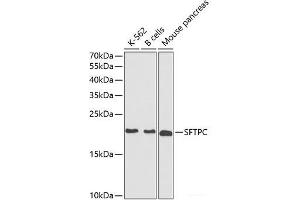 Western blot analysis of extracts of various cell lines using SFTPC Polyclonal Antibody at dilution of 1:1000.