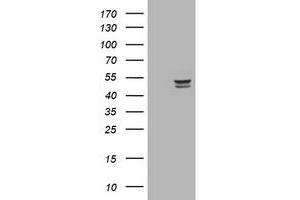 Image no. 3 for anti-Thymidine Phosphorylase (TYMP) (AA 311-482) antibody (ABIN1491394) (Thymidine Phosphorylase antibody  (AA 311-482))