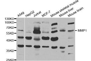 Western blot analysis of extracts of various cell lines, using MMP1 antibody. (MMP1 antibody  (AA 20-280))