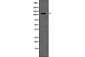 Western blot analysis of SLC12A2 expression in HEK293 cells ,The lane on the left is treated with the antigen-specific peptide. (SLC12A2 antibody  (Internal Region))