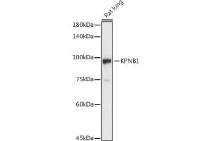 Western blot analysis of extracts of Rat lung, using KPNB1 antibody (ABIN6134722, ABIN6142997, ABIN6142998 and ABIN6224723) at 1:1000 dilution. (KPNB1 antibody  (AA 250-350))