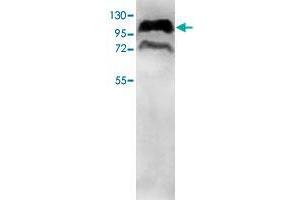 Western blot analysis of HepG2 cell lysate with PPP1R10 polyclonal antibody  at 1 : 500 dilution. (PPP1R10 antibody  (AA 661-929))