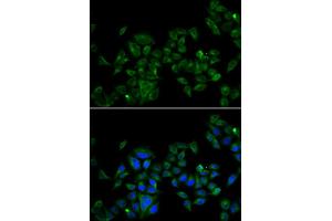 Immunofluorescence analysis of U2OS cell using MAGED1 antibody. (MAGED1 antibody)