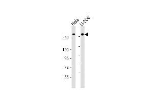 All lanes : Anti-FANCM Antibody (C-Term) at 1:2000 dilution Lane 1: Hela whole cell lysate Lane 2: U-2OS whole cell lysate Lysates/proteins at 20 μg per lane. (FANCM antibody  (AA 1752-1783))