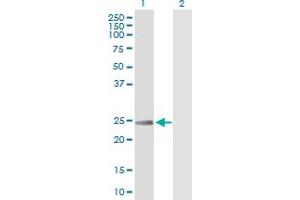 Western Blot analysis of RRAS expression in transfected 293T cell line by RRAS MaxPab polyclonal antibody. (R-Ras antibody  (AA 1-218))