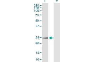 Western Blot analysis of RRAS expression in transfected 293T cell line by RRAS MaxPab polyclonal antibody. (R-Ras antibody  (AA 1-218))