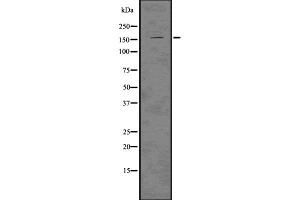 LATS1 antibody  (Internal Region)