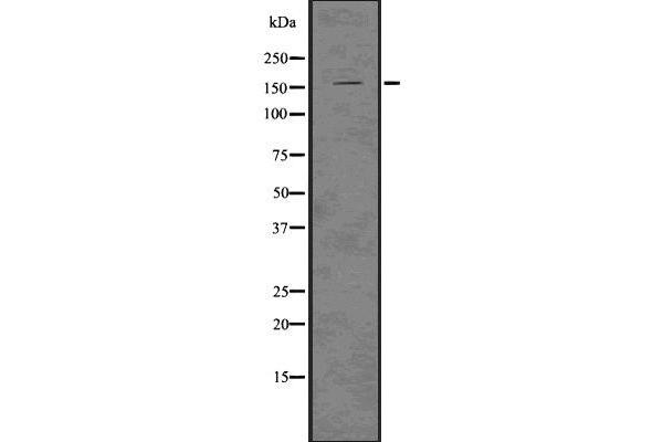 LATS1 antibody  (Internal Region)