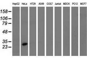 Western blot analysis of extracts (35 µg) from 9 different cell lines by using anti-GSTT2 monoclonal antibody. (GSTT2 antibody)
