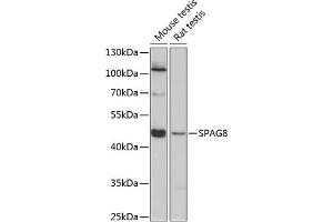 Western blot analysis of extracts of various cell lines, using SP antibody (ABIN6129712, ABIN6148323, ABIN6148324 and ABIN6224831) at 1:3000 dilution. (SPAG8 antibody  (AA 220-420))