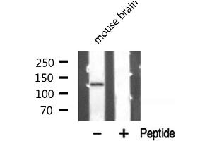 Western blot analysis of PKCB1 expression in Mouse brain lysate (ZMYND8 antibody  (Internal Region))