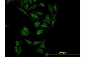 Immunofluorescence of monoclonal antibody to HTRA2 on HeLa cell. (HTRA2 antibody  (AA 359-458))