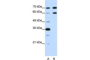 WB Suggested Anti-DMRT2 Antibody Titration:  1. (DMRT2 antibody  (N-Term))