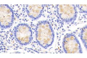 Detection of CLCA1 in Human Colon Tissue using Polyclonal Antibody to Chloride Channel Accessory 1 (CLCA1) (CLCA1 antibody  (AA 416-670))