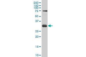 TGIF2 monoclonal antibody (M04), clone 5G6 Western Blot analysis of TGIF2 expression in Hela S3 NE . (TGIF2 antibody  (AA 131-236))