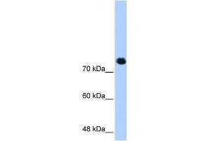 WB Suggested Anti-SMC3 Antibody Titration:  0. (SMC3 antibody  (C-Term))