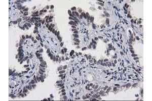 Image no. 1 for anti-Myocyte Enhancer Factor 2C (MEF2C) antibody (ABIN1499362) (MEF2C antibody)