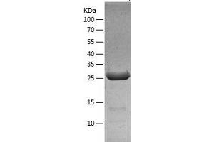 FGF5 Protein (AA 18-268) (His tag)