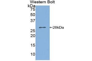 Western blot analysis of the recombinant protein. (PNPLA2 antibody  (AA 481-702))