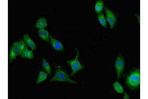 Immunofluorescent analysis of A549 cells using ABIN7159328 at dilution of 1:100 and Alexa Fluor 488-congugated AffiniPure Goat Anti-Rabbit IgG(H+L) (AOC3 antibody  (AA 27-259))