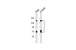 All lanes : Anti-NASP Antibody (N-term) at 1:1000 dilution Lane 1: Hela whole cell lysate Lane 2: human testis lysate Lysates/proteins at 20 μg per lane. (NASP antibody  (N-Term))