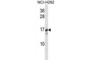 Western Blotting (WB) image for anti-Trafficking Protein Particle Complex 2 (TRAPPC2) antibody (ABIN2995169) (TRAPPC2 antibody)