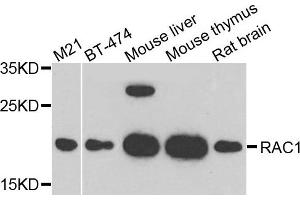 Western blot analysis of extract of various cells, using RAC1 antibody. (RAC1 antibody)