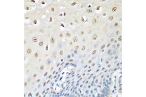 Immunohistochemistry of paraffin-embedded human esophagus using VCP antibody (ABIN6290879) at dilution of 1:200 (40x lens). (VCP antibody)
