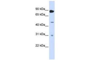 Image no. 1 for anti-Adenosine Deaminase, RNA-Specific, B1 (ADARB1) (N-Term) antibody (ABIN6742969) (RED1 antibody  (N-Term))
