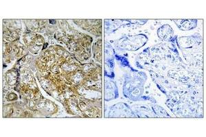 Immunohistochemical analysis of paraffin-embedded human placenta tissue using PAK1/2 (Phospho-Ser199) antibody (left)or the same antibody preincubated with blocking peptide (right). (PAK1 antibody  (pSer199))