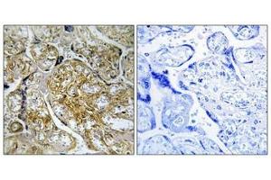 Immunohistochemical analysis of paraffin-embedded human placenta tissue using PAK1/2 (Phospho-Ser199) antibody (left)or the same antibody preincubated with blocking peptide (right). (PAK1 antibody  (pSer199))