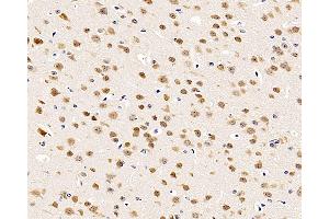 Immunohistochemistry analysis of paraffin-embedded mouse brain using RBFOX3 Polyclonal Antibody at dilution of 1:500. (NeuN antibody)