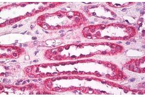 Image no. 1 for anti-Aquaporin 1 (Colton Blood Group) (AQP1) (AA 1-10) antibody (ABIN1494240) (Aquaporin 1 antibody  (AA 1-10))