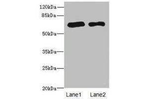 Western blot All lanes: PPM1Dantibody at 2. (PPM1D antibody  (AA 1-250))