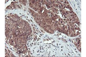 Image no. 4 for anti-Haloacid Dehalogenase-Like Hydrolase Domain Containing 1 (HDHD1) antibody (ABIN1498625) (HDHD1 antibody)