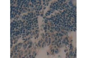 IHC-P analysis of Human Tissue, with DAB staining. (CCL21 antibody  (AA 24-134))