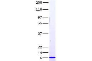 Validation with Western Blot (CXCL1 Protein)