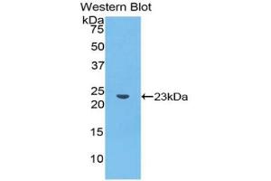Western blot analysis of the recombinant protein. (Caspase 4 antibody  (AA 81-270))