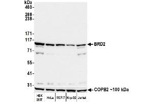 Western Blotting (WB) image for anti-Bromodomain Containing 2 (BRD2) (AA 675-725) antibody (ABIN7452646)