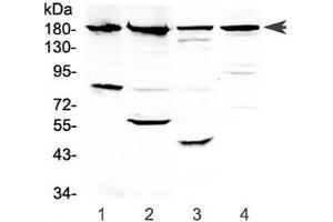 Western blot testing of 1) human PANC-1, 2) human placenta, 3) rat kidney and 4) mouse kidney lysate with ERBB4 antibody at 0.