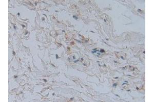 Used in DAB staining on fromalin fixed paraffin-embedded heart tissue (GLRX3 antibody  (AA 144-234))