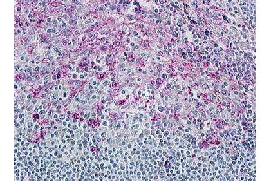 Immunohistochemical (Formalin/PFA-fixed paraffin-embedded sections) staining in human tonsil with CCR8 polyclonal antibody . (CCR8 antibody  (3rd Cytoplasmic Domain))