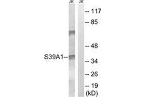 Western Blotting (WB) image for anti-Solute Carrier Family 39 (Zinc Transporter), Member 1 (SLC39A1) (AA 111-160) antibody (ABIN2890707) (SLC39A1 antibody  (AA 111-160))