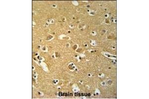 Immunohistochemistry (Paraffin-embedded Sections) (IHC (p)) image for anti-BRISC and BRCA1 A Complex Member 1 (BABAM1) (AA 9-37), (N-Term) antibody (ABIN652513)