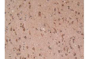 Detection of EZH2 in Human Brain Tissue using Polyclonal Antibody to Enhancer Of Zeste Homolog 2 (EZH2) (EZH2 antibody  (AA 51-285))