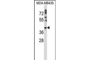 DNAJC28 Antibody (C-term) (ABIN657516 and ABIN2846538) western blot analysis in MDA-M cell line lysates (35 μg/lane). (DNAJC28 antibody  (C-Term))