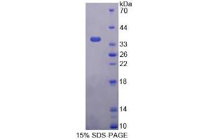 SDS-PAGE (SDS) image for Pyridoxamine 5'-Phosphate Oxidase (PNPO) (AA 1-261) protein (His tag) (ABIN6238809)