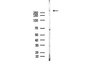 anti-E1A Binding Protein P300 (EP300) (N-Term) antibody