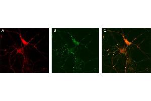 Immunocytochemistry (ICC) image for anti-Glutamate Decarboxylase 1 (Brain, 67kDa) (GAD1) (AA 3-101) antibody (ABIN1742415) (GAD antibody  (AA 3-101))