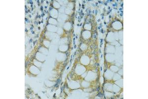 Immunohistochemistry of paraffin-embedded human colon using CYP2B6 antibody (ABIN5997556) at dilution of 1/100 (40x lens).